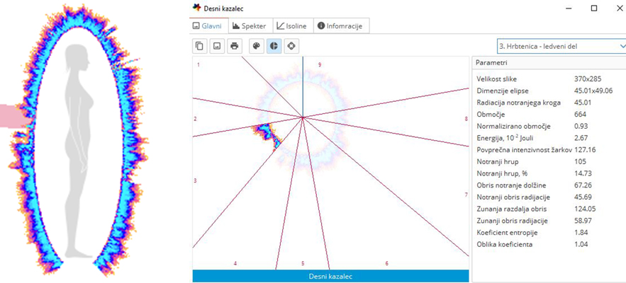 Biopolje desnega kazalca
